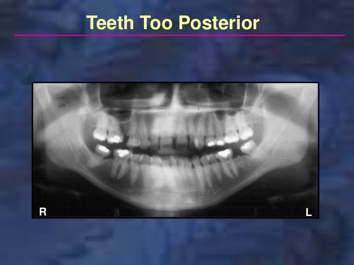 panoramic radiography